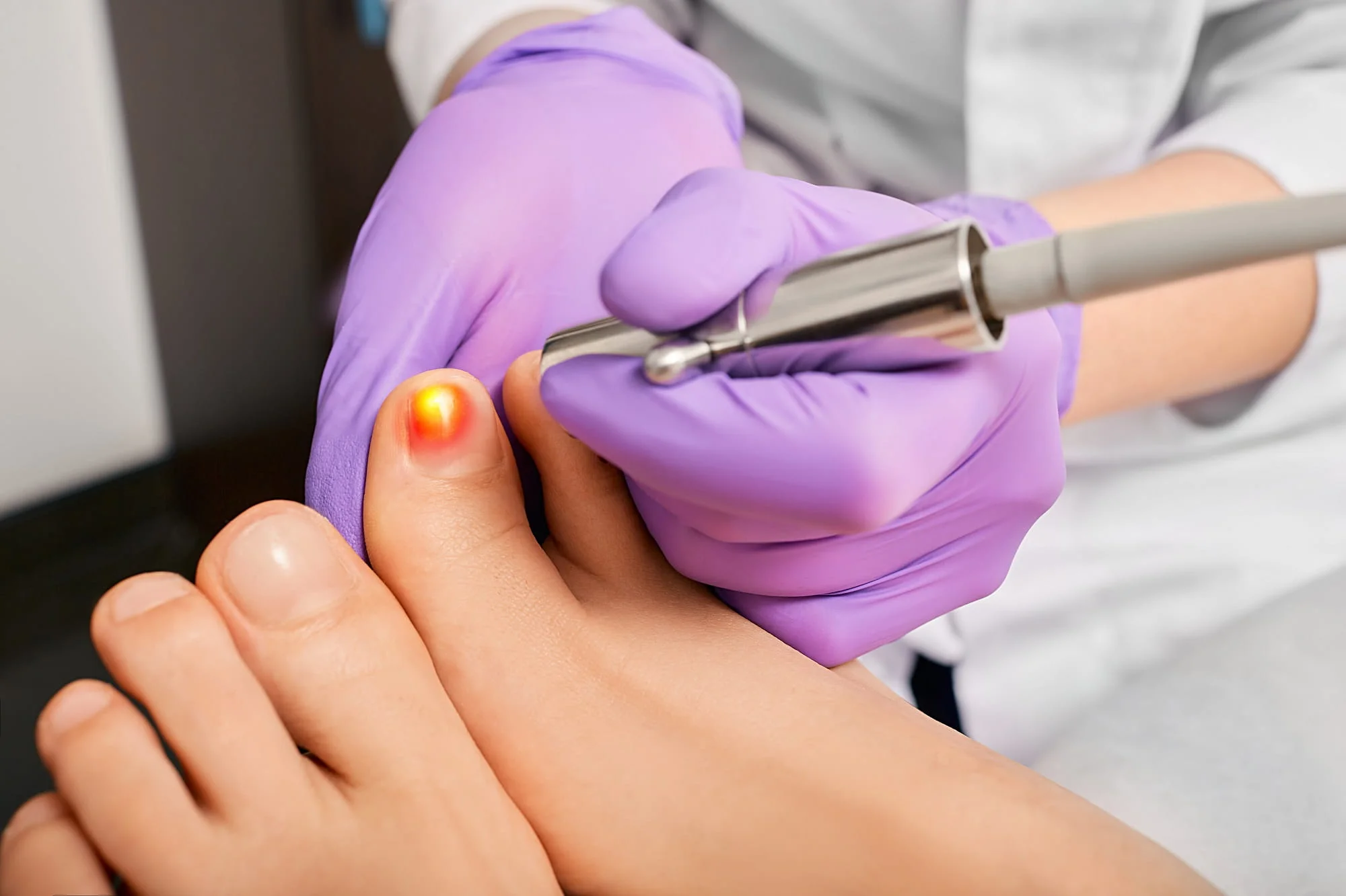 Why Do Pedicures Hurt and How Can I Prevent Pain